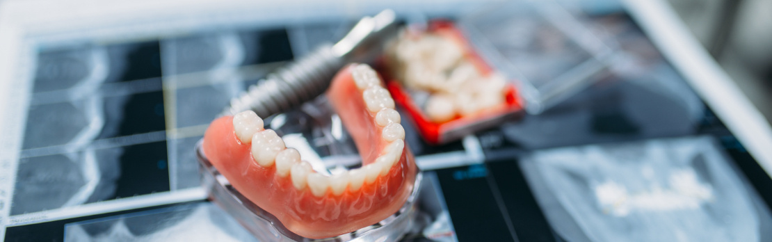 Dentures